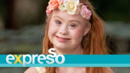 Model Madeline Stuart living with Down Syndrome
