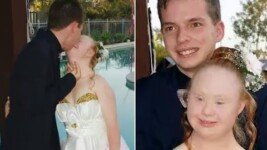 Model With Down's Syndrome Finds Love - Madeleine Stuart