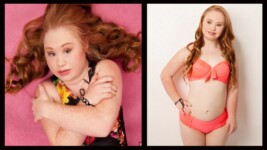 The Down Syndrome Supermodel...Meet Madeline Stuart